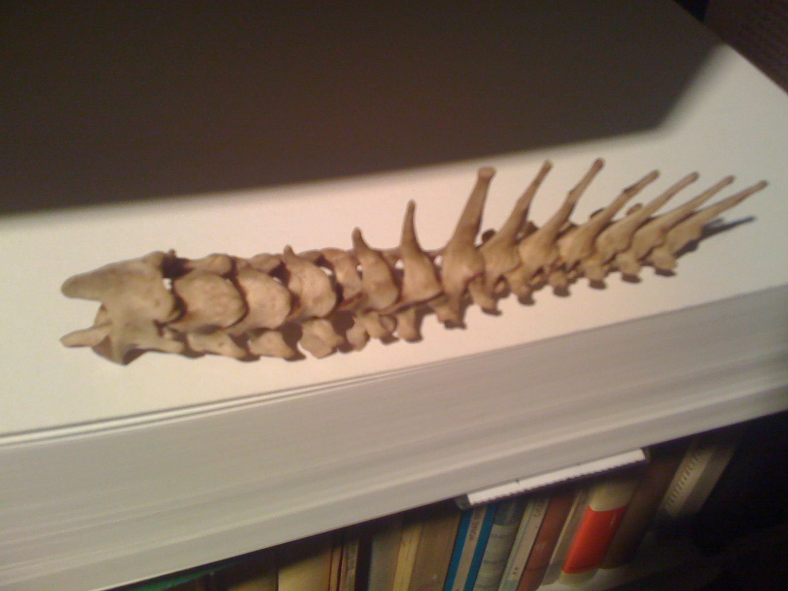sezione di colonna vertebrale - di cosa?